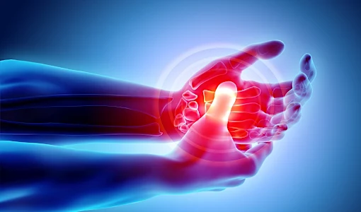 8 Signs You May Have Rheumatoid Arthritis. Research ICD 10 For Rheumatoid Arthritis 8 Signs You May Have Rheumatoid Arthritis. Research ICD 10 For Rheumatoid Arthritis