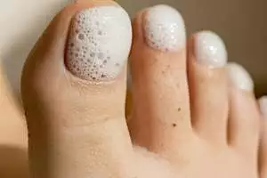 Você sofre de micose nas unhas? Experimente este truque simples hoje à noite (é genial!). Você sofre de micose nas unhas? Experimente este truque simples hoje à noite (é genial!).