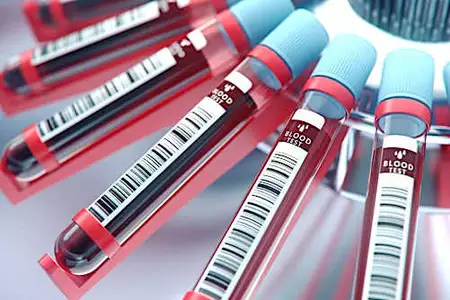 New Multi-Cancer Detection Data Speak to Both Promises and Cautions of Blood-Based Assays