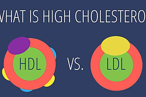 This Is What High Cholesterol Does to Your Body