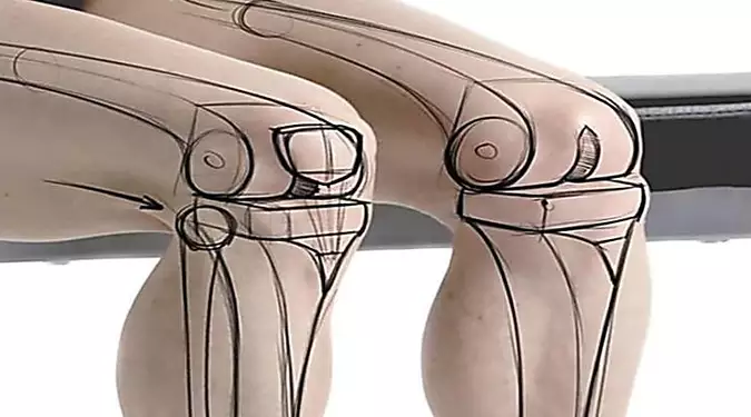 If You Suffer From Knee and Hip Pain You Should Read This