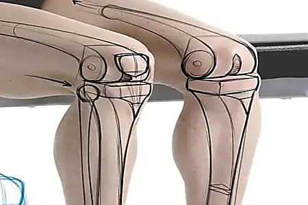 If You Suffer From Knee and Hip Pain You Should Read This