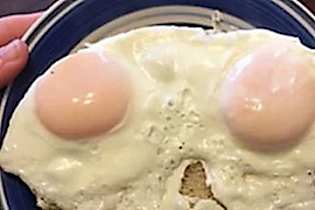 Anyone With Type 2 Diabetes Should Watch This!