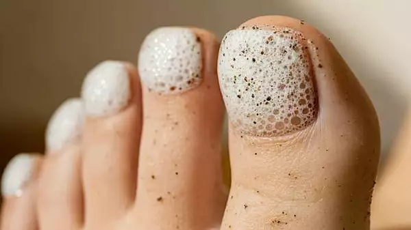 Μύκητες στα νύχια; Αυτή η απλή μέθοδος έχει κερδίσει χιλιάδες.
