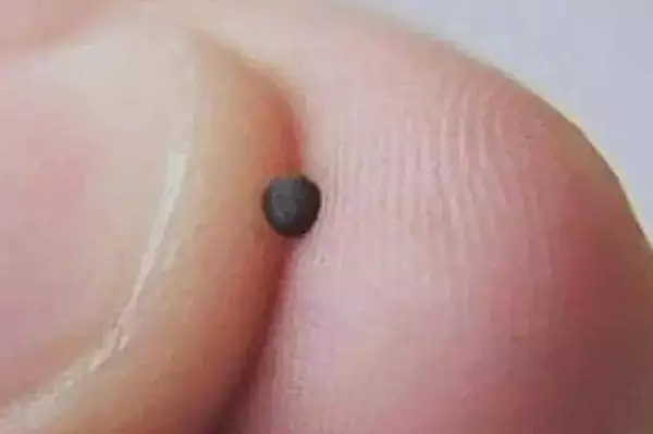 Ο μεγαλύτερος εχθρός της αιμορροΐδας! Διαβάστε αυτό το άρθρο.