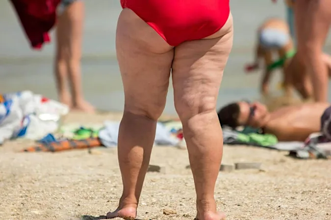 Dermatologist: The Best Way To Reduce Cellulite After 50 (It's Genius)