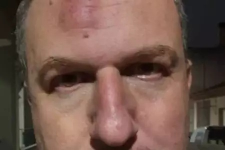 ΣΥΡΙΖΑ - Νέα Αριστερά / Ο ξυλοδαρμός του δημοσιογράφου Καρεκλίδη μας σοκάρει, αλλά δεν μας τρομοκρατεί