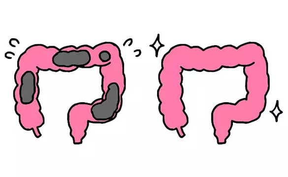 65歳「森下仁丹の腸活サプリがすごい」