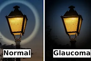 Image 53: 视力下降?97%的眼科检查遗漏了这一新型关联