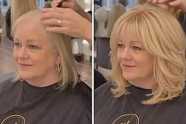 The Surprising Household Item People Are Using for Hair Regrowth
