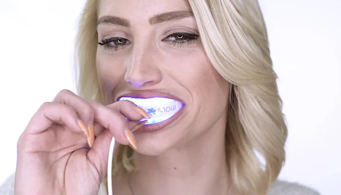 At-Home Teeth Whitening System Used by Celebrities