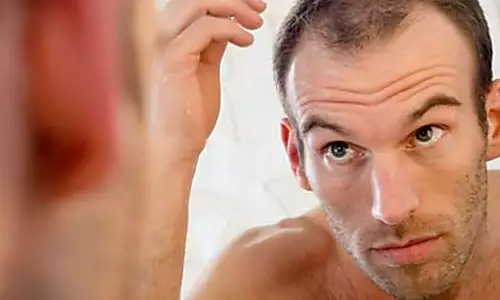 Hair Transplant Prices Might Surprise You