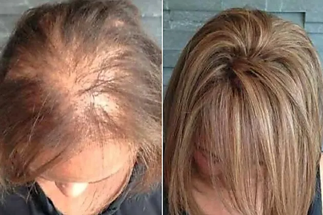 Λεπτά μαλλιά σε μεγάλη ηλικία: 1 αρχαία θεραπεία βοηθά