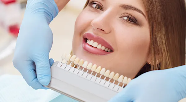 Implantes dentários no Chorozinho: lista de preços