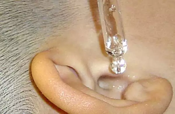 Brain Surgeon - Do This to Relieve Tinnitus and Hearing Loss (Try Tonight)!