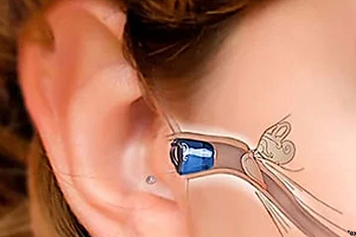 Wanted: People to Try Latest High-Tech Hearing Aids in Sydney