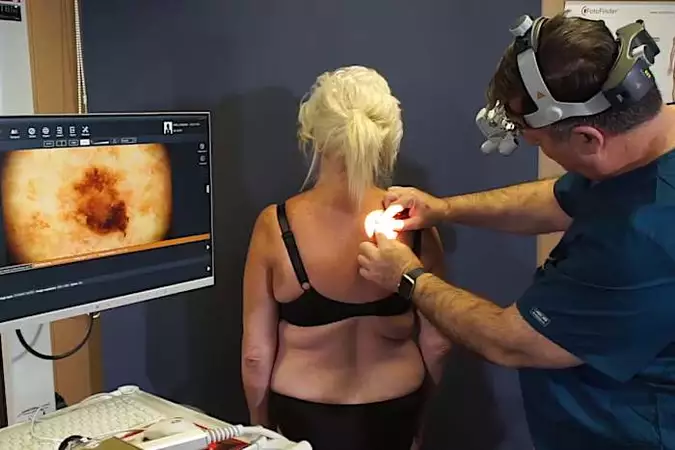 Ξέρεις ότι το μελάνωμα στο δέρμα μπορεί να θεραπευτεί; Ξέρεις ότι το μελάνωμα στο δέρμα μπορεί να θεραπευτεί;