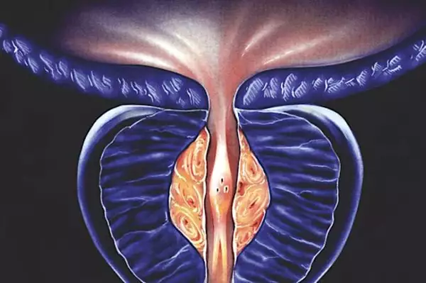 Urologist: Enlarged Prostate? Every Man Should Do This Before Bed! Urologist: Enlarged Prostate? Every Man Should Do This Before Bed!