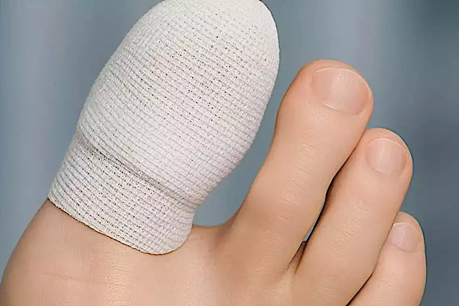 Médecin: Voici l’astuce simple de 2026 contre la mycose de l’ongle (c’est génial)