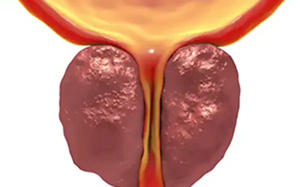 Top US Men's Surgeon: Do This Once Daily To 'Shrink' an Enlarged Prostate