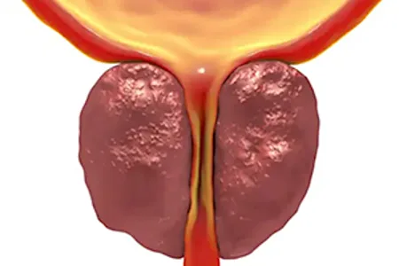 Top US Men's Surgeon: Do This Once Daily To Shrink an Enlarged Prostate!