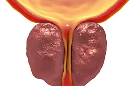 Top US Men's Surgeon: Do This Once Daily To 'Shrink' an Enlarged Prostate