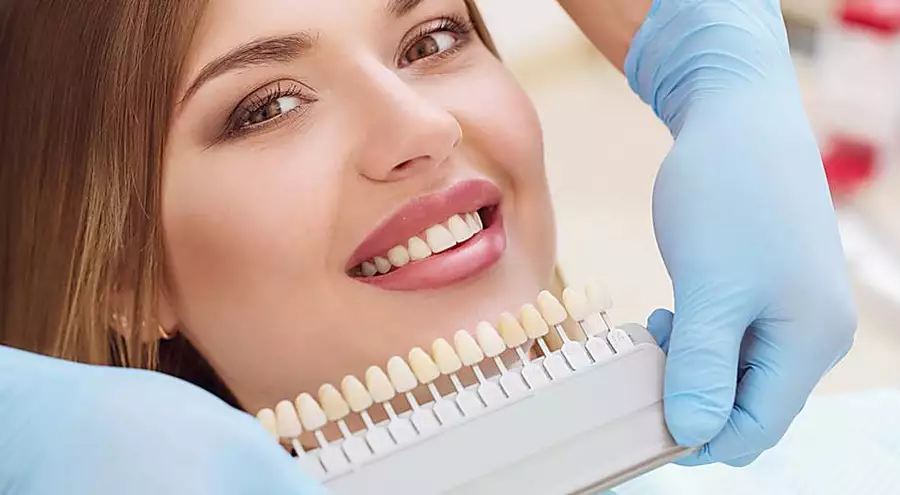 Implantes dentários: lista de preços