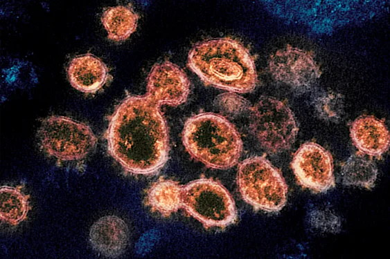 Οι ερευνητές πιστεύουν ότι το COVID-19 μπορεί να επηρεάσει τη γονιμότητα των ανδρών Οι ερευνητές πιστεύουν ότι το COVID-19 μπορεί να επηρεάσει τη γονιμότητα των ανδρών