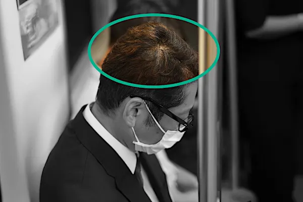 「頭頂部が透けて見えたら」バスクリンが快挙！有効成分生薬100%の育毛剤を開発