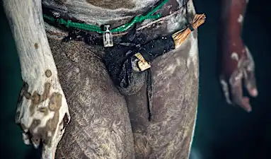 En Afrique du Sud, le combat d’une femme médecin contre les circoncisions rituelles