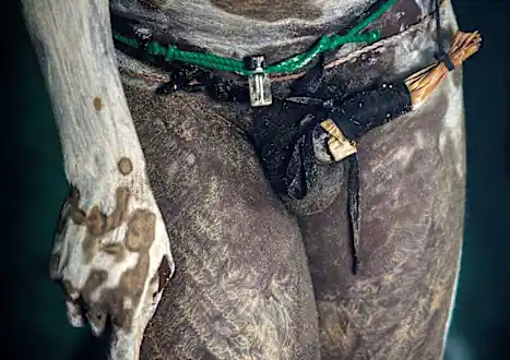 En Afrique du Sud, le combat d’une femme médecin contre les circoncisions rituelles