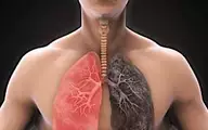 What Causes COPD?