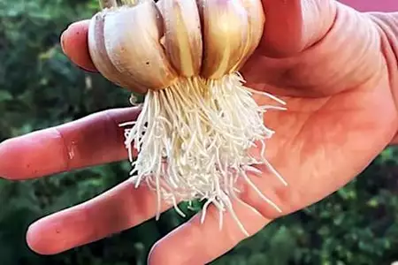 Αν έχετε κονδυλώματα στο λαιμό ή στις μασχάλες, διαβάστε αυτό!