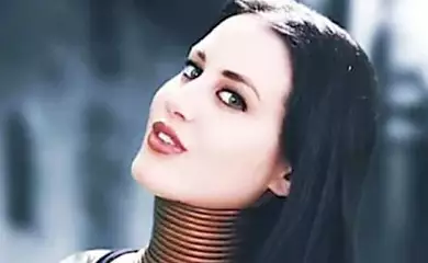 [Fotos] Mujer jirafa finalmente se quita los anillos después de cinco años