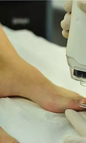 Μάθε πώς φεύγουν οι μύκητες από τα νύχια Μάθε πώς φεύγουν οι μύκητες από τα νύχια