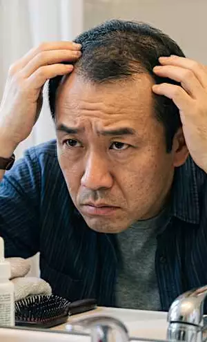 【世界初】頭皮に刺すスカルプケアが男性の救世主と話題に