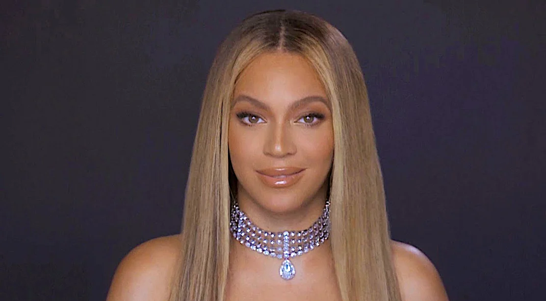 Celebrities then and now: How they've changed Celebrities then and now: How they've changed