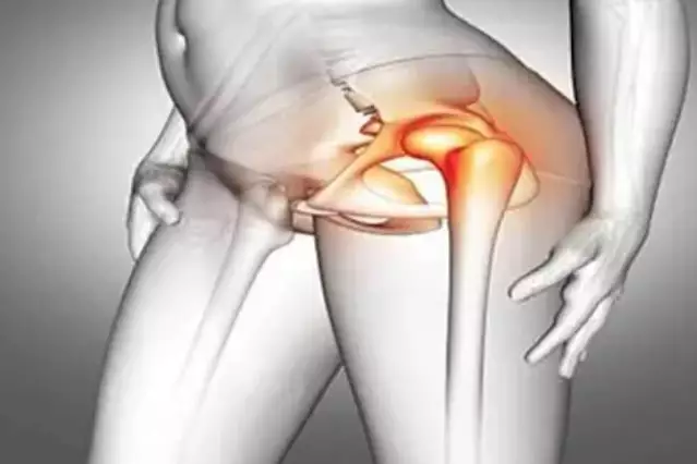 Arthrose & Schmerzen: Dieses einfache Mittel bringt Bewegung zurück