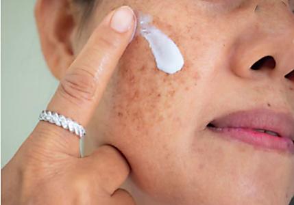 Soak Your Dark Spots With This One Thing (Trending Morning Routine)