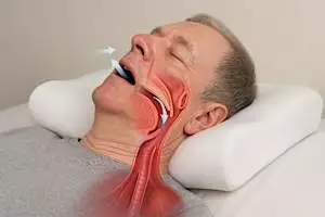 Sleep Apnea: Ingenious Pillow Takes The US By Storm