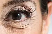 Dermatologista: 1 Dica Genial Elimina Rugas E Bolsas Sob Os Olhos
