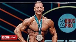 Bodybuilder with three kidneys wins Euro title