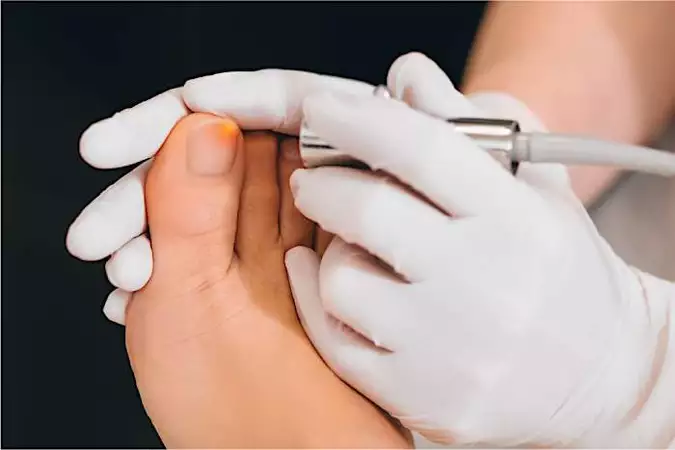 Ξέρεις πώς αντιμετωπίζεται η ψωρίαση στα νύχια; Ξέρεις πώς αντιμετωπίζεται η ψωρίαση στα νύχια;