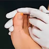 Ξέρεις πώς αντιμετωπίζεται η ψωρίαση στα νύχια;