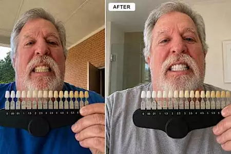 We've tested 27 popular teeth whitening products: These 5 are the best