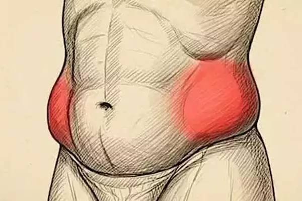 Καρδιολόγος εξηγεί γιατί το λίπος στην κοιλιά επιδεινώνεται μετά τα 50