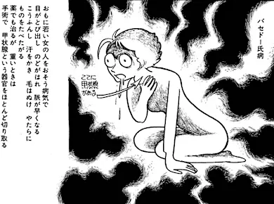 バセドウ病っていう病気の苦行がこちらwwwwww