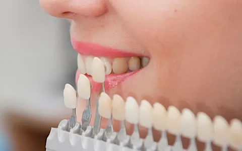 They Look And Feel Like Real Teeth. Here's What They Cost