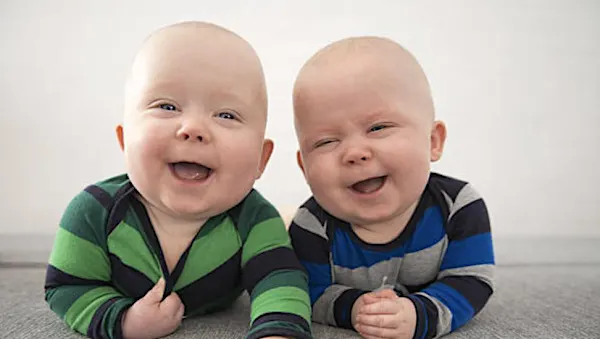 Unique and Rare Types of Twins