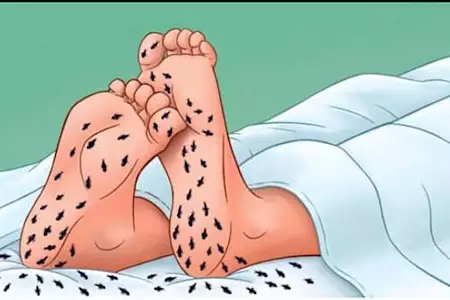 Lorsque la neuropathie frappe, essayez ceci (c'est génial !)